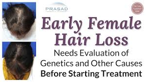 Affected women may experience psychological distress and impaired social functioning. Treating Difficult Female Pattern Hair Loss Successfully In Over 99 Of Patients Youtube