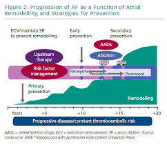 Image result for Atrial Fibrillation Rhythm Control