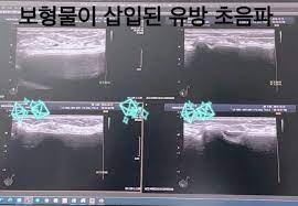 수다 겜주님 선정 최고의 메이플 성형. ìžê¾¸ ê°€ì§œë¼ê³  í•´ì„œ ë³´ì—¬ì¤ë‹ˆë‹¤ ì§ì ' ê°€ìŠ´ ì¸ì¦í•œ ì—¬ìž ìœ íŠœë²„