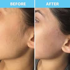 skin ™ Peach Fuzz Hair Cream