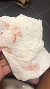 10dpo Implantation Bleeding