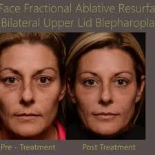 BRIAN S. BIESMAN, M.D