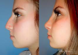 Leading Las Vegas Plastic Surgery