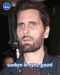 Has 'Ozempic face' gone too far?