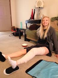 Acl reconstruction knee surgery involves replacing the torn anterior cruciate ligament with a new graft. Pin On Lifestyle