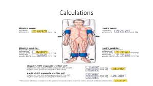 Ankle Brachial Pressure Index Abpi