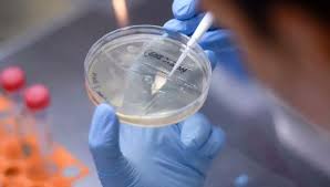 La cepa b.1.617 presenta unas15 mutaciones, concentrándose dos de ellas, la e484q y l452r, en la espícula del. Variante Delta Del Coronavirus Duplica Riesgo De Hospitalizacion Por Covid 19 Advierte Estudio Escoces Mundo Gestion
