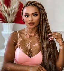 Ex-BBB Natália Deodato revela tentativas de suicídio e depressão