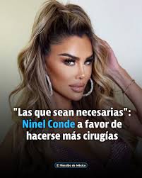 Una de las preguntas que el Escorpión le hizo fue cuál sería su próxima  cirugía estética, a lo que Ninel contestó que sería una remodelación costal  para afinar su silueta. Sobre una