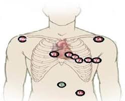 10 Lead Ecg System Download Scientific Diagram