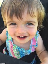 Geelong toddler Lesley Dunn fell head first from two-storeys and survived