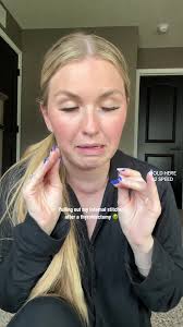 Removing Internal Stitches