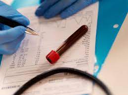 If you can't wait that long, ask your health care provider for a blood test. How Long Does It Take To Receive Blood Test Results A Guide