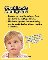 Image result for Amblyopia