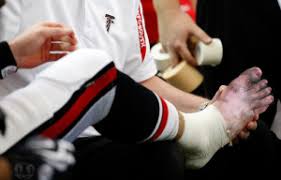 Turf toe can range from a mild injury with only minor ligament damage to a chronic injury involving inflammation of the joint capsule and progressive cartilage formation and. Turf Toe Artesia Big Toe Joint Sprain Rancho Cucamonga Sports Injury Treatment