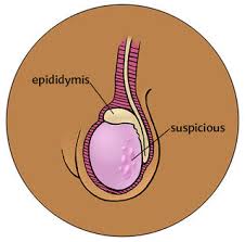 These and other signs and symptoms may be caused by testicular cancer or by other conditions. How To Do A Testicle Exam And Five Reasons Men Avoid Them Psychology Today