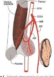 The medial condyle is one of the two projections on the lower extremity of femur, the other being the lateral condyle. A Composite Osteomusculocutaneous Free Flap From The Medial Femoral Condyle For Reconstruction Of Complex Defects Semantic Scholar