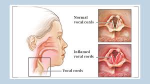 The example above shows different couples on a date, going. How To Keep Your Voice Healthy Theindependentbd Com