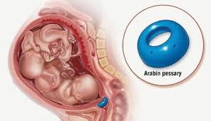 164 bpm, the other one is 33,7 x 18,4 fetal length: Twin Pregnancy Obstetric Care Guidelines Brigham And Women S Hospital