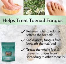 Can help with nausea (again great for those essential oils for exercises aren't a new thing, we're just coming at them in a new way. Prepper Foot Care