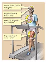 Image result for Exercise in COPD