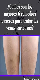 Pin On Tablero De Belleza