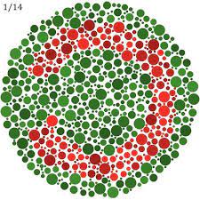 This condition is benign and usually does not affect daily life. Color Blind Test