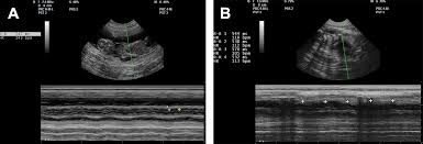 Gestational Aging And Determination Of Parturition Date In The Bitch And Queen Using Ultrasonography And Radiography Veterinary Clinics Small Animal Practice