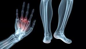 Image result for Hand Growth Plates