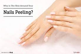 Check spelling or type a new query. Why Is The Skin Around Your Nails Peeling By Dr Lakshmi Manasi Lybrate