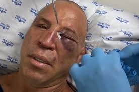 Bees Knees: Bellator 77 lightweight Dave Jansen interview exclusive with  MMAmania.com