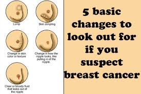 If the cancer's in an early stage, you may feel more open about sharing this info. Breast Cancer Symptoms Causes And Diagnosis