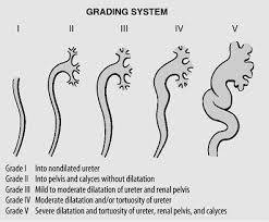 Vur can increase the risk of a kidney uti (also called pyelonephritis). 35 Vesicoureteral Reflux Smiths General Urology Seventeenth Edition Lange Clinical Medicine