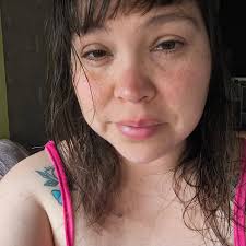 LUCHA CONTRA EL CÁNCER Con apenas 23 años, Kimberly busca ayuda para  costear un tratamiento en el extranjero que podría devolverle la salud… y  la esperanza.