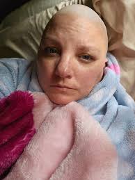 Day after chemo. It brings so much weakness. Such a drastic change while it  takes