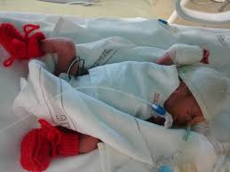 Ab wann sind babys lebensfähig? Gastbeitrag Zum Welt Fruhgeborenen Tag Mein Sohn Wog Bei Der Geburt Gerade Mal 900 Gramm Stadt Land Mama