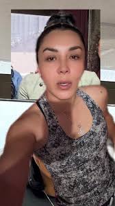 Resultados sorprendentes de Endolifting con Dra. Karina