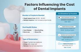 Image result for dental implant
