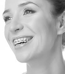 This covers everything from disney, to harry potter, and even emma stone movies, so get ready. Ortho 101 Bronsky Orthodontics Nyc
