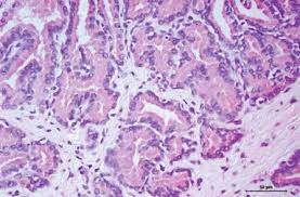 prostate cancer, on the other hand, is caused by changes in the dna that prompt the abnormal multiplication of cancer cells in the prostate. Anatomy Histology And Physiology Of The Canine Prostate Gland Intechopen