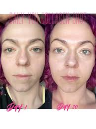 Denise just shared her collagen results. Here are her words: “I've been  pretty quiet about my Collagen results but I still can't stop smiling about  them 😃 Started Jan 2022 and today,