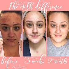 Hi beautiful ladies of Kinsale. If you've been thinking you'd like to use  more natural skincare products, this is your chance to learn about the best  natural ingredients to use