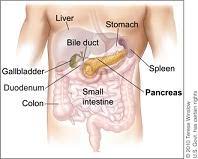 Lung cancer findings about test name: Pancreatic Cancer Physiopedia