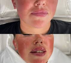 Advanced practitioner offering treatments to have you feeling your best  self. Have you booked your appointment? ✨💕🥰