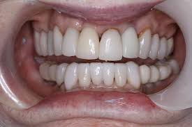 116 high street, holywood, bt18 9hw: Health And Dental Education Archives Smile Sarasota