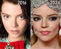 Ana Taylor-Joy: svelato il mistero di un volto ammaliante