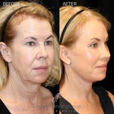 Lindsey Pennington, M.D. Facial Plastics