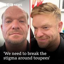 How to use the word toupee in a sentence?