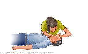 Part of cpr training now includes how to operate an automatic electronic defibrillator. Cardiopulmonary Resuscitation Cpr First Aid Mayo Clinic
