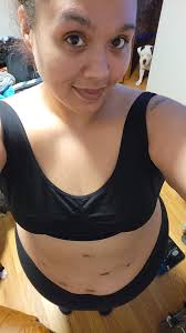 Can I take before and after pictures at Hazard ARH?